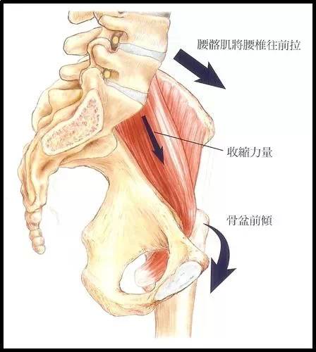 jpg二,髋部周围肌肉失衡使得股骨颈过度前倾或后倾.