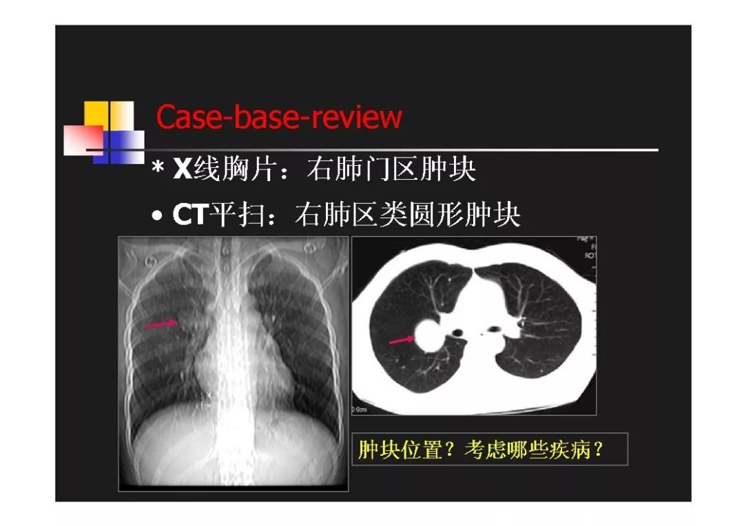 肺门小图片