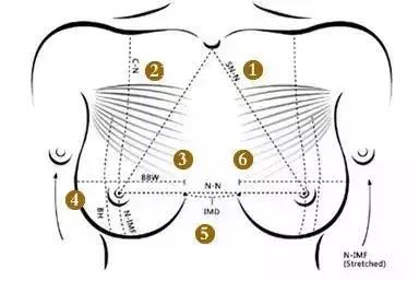 乳房图凹陷图片