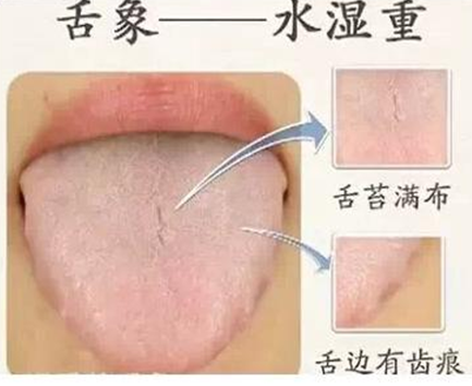 老中医看舌头到底看出了什么舌象配图每人都能看懂