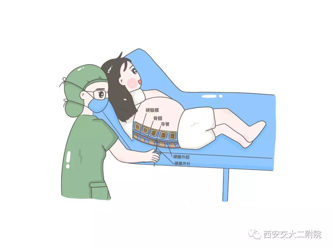 10号参赛作品无痛分娩让女人优雅做妈妈