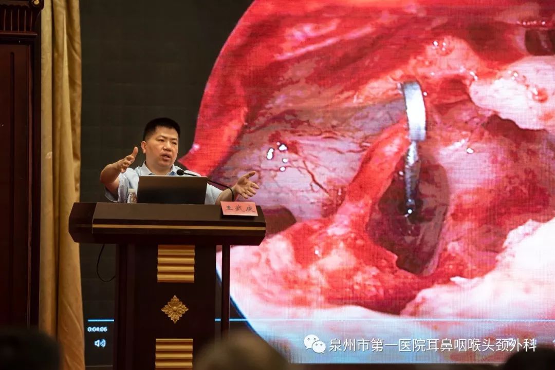 张秋航教授,余洪猛教授及廖军与大家分享了鼻咽癌外科治疗的宝贵经验