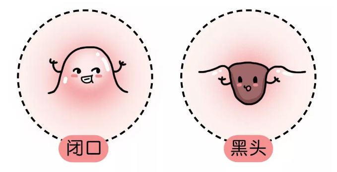 花容月貌小讲堂遇到闭口不要慌不要抠更不用丧