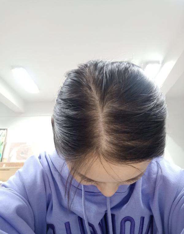 发量少适合短发?不一定哦!你又不是辛芷蕾,你还得会打理