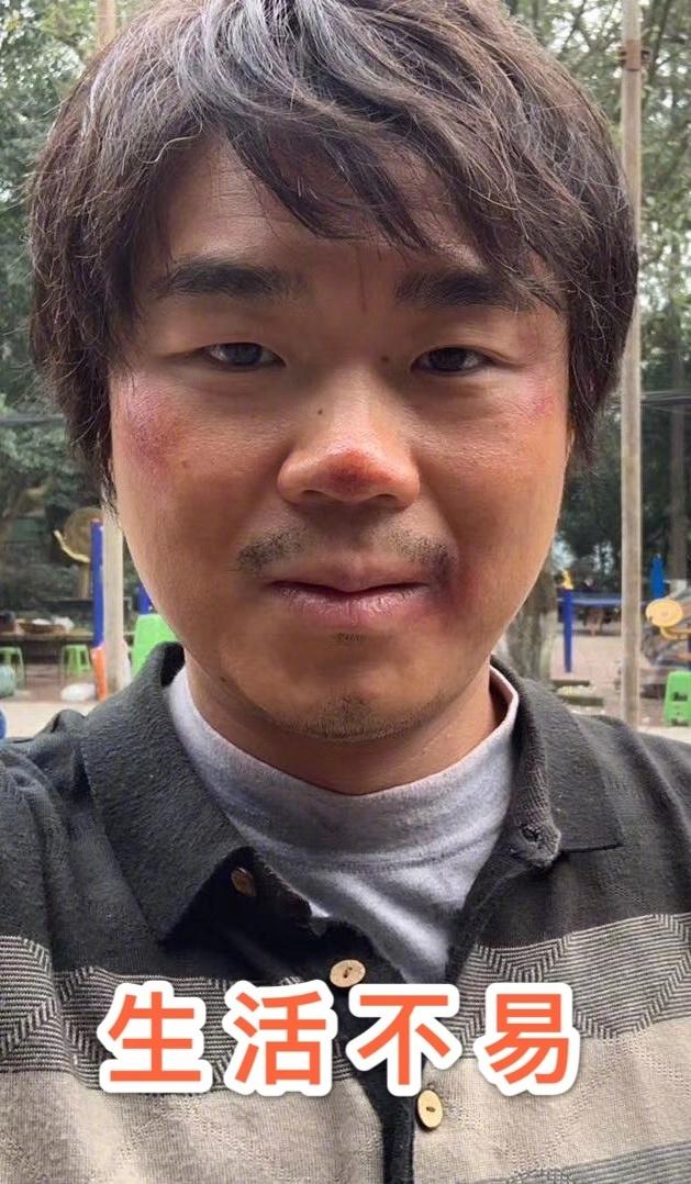 原创大鹏董成鹏晒近照认不出到底发生了什么