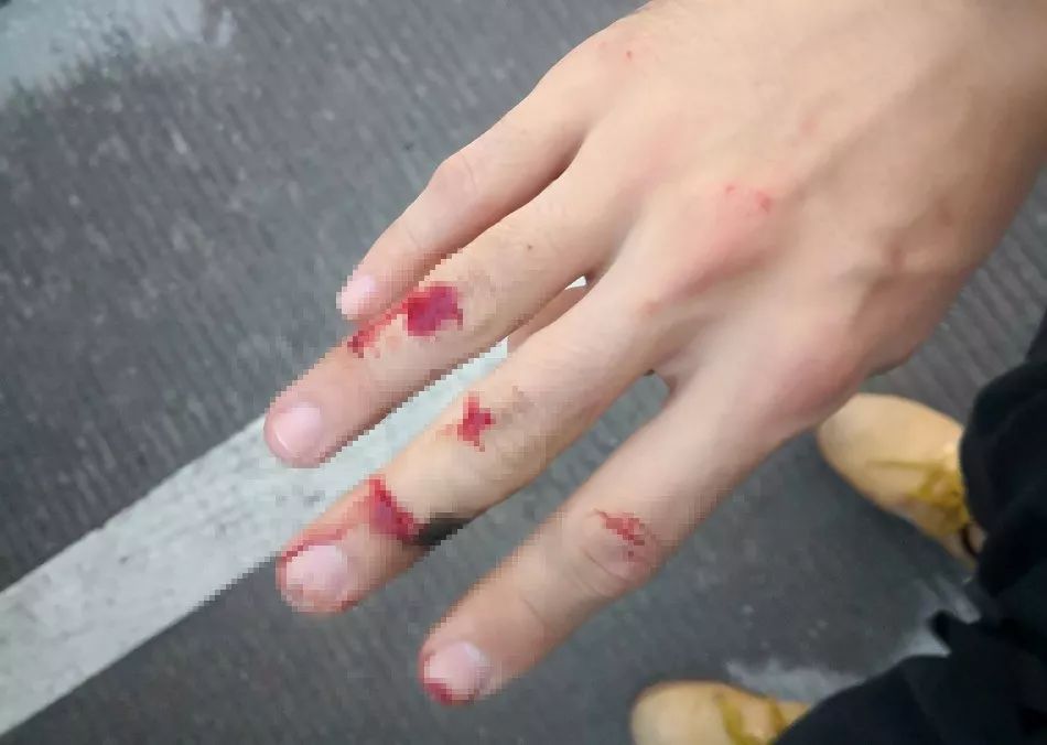 凌晨5点开平民警破窗抓犯有人受伤流血