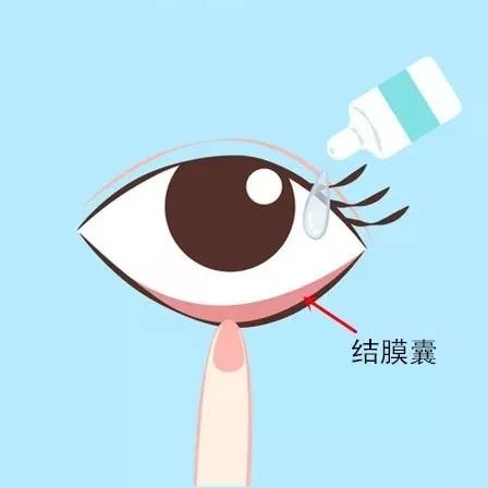 用了这么多年眼药水,你真的了解它吗