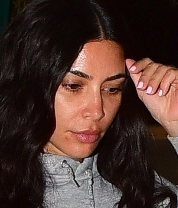 性感的金卡戴珊呢?素颜出街满脸油光还长痘,我都差点没认出来_金姐