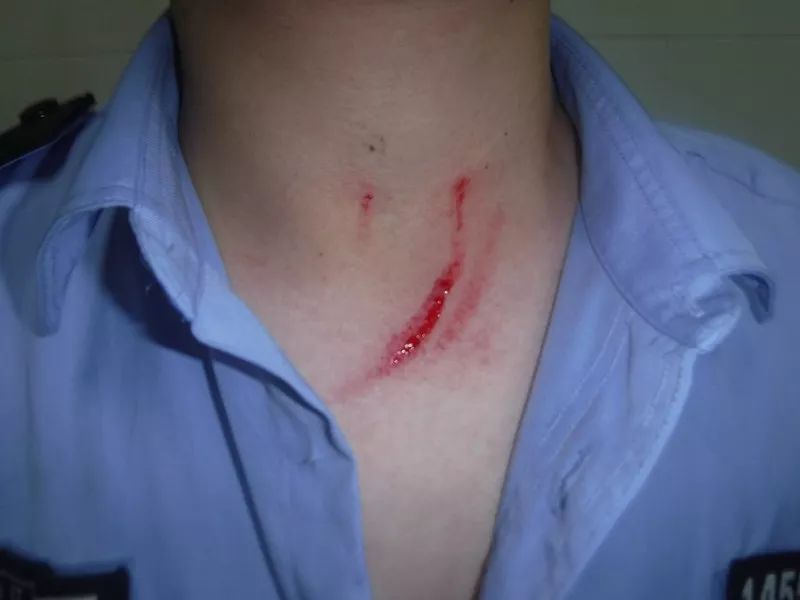 抓扯等手段,将民警颈部抓出血,警服肩章扯下,一名辅警右前臂被抓伤