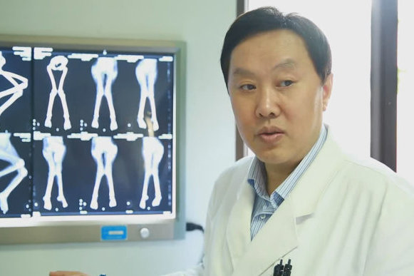 膝外翻矫正的最佳年纪——王江宁