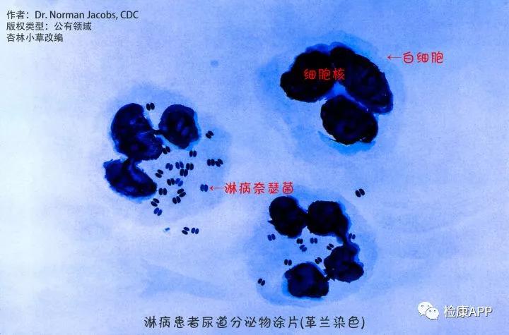 如图所示,淋病奈瑟菌是一种双球菌(成双成对出现的球形/椭球形细菌)