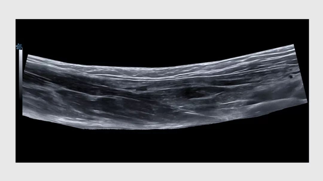 超声微课堂蓝韵影像超声时代新生于此启航