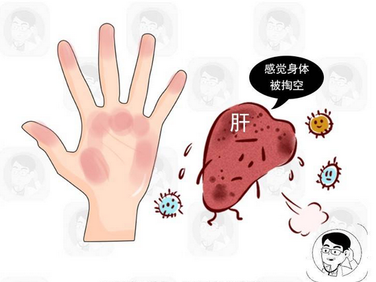 原创口臭出现这种味道要小心肝脏出问题了可能是肝脏受损的信号