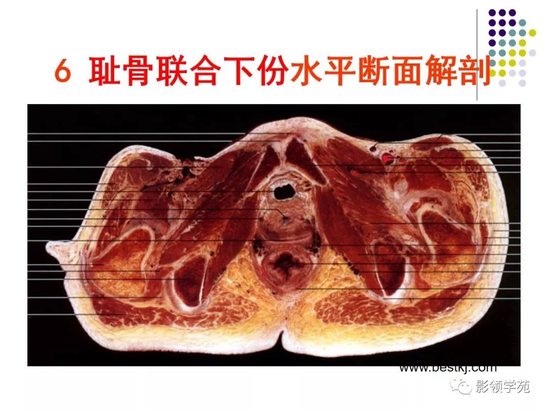 女性盆腔水平断面解剖_图谱
