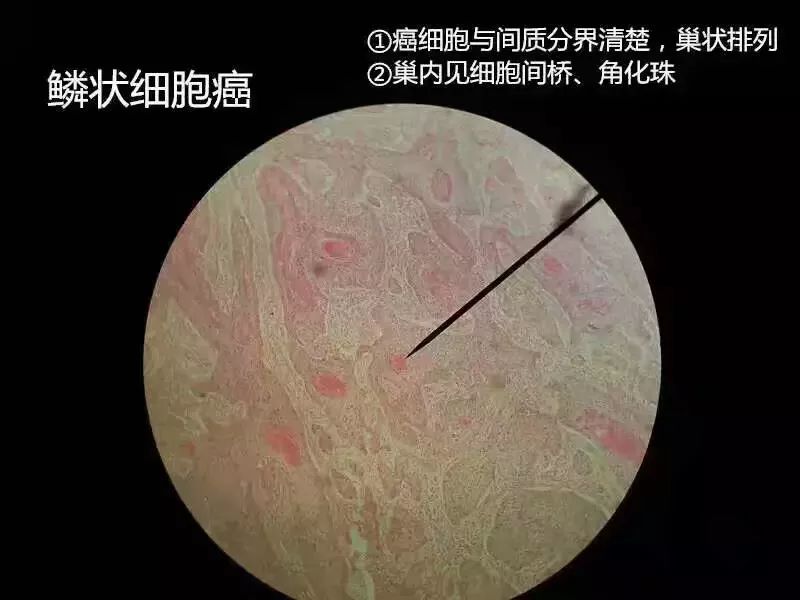 病理学切片库