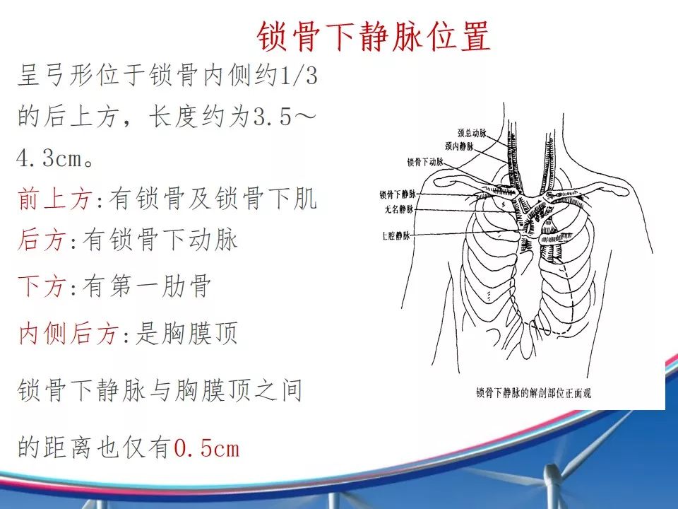 2019了, cvc 中心静脉导管还怎么维护?