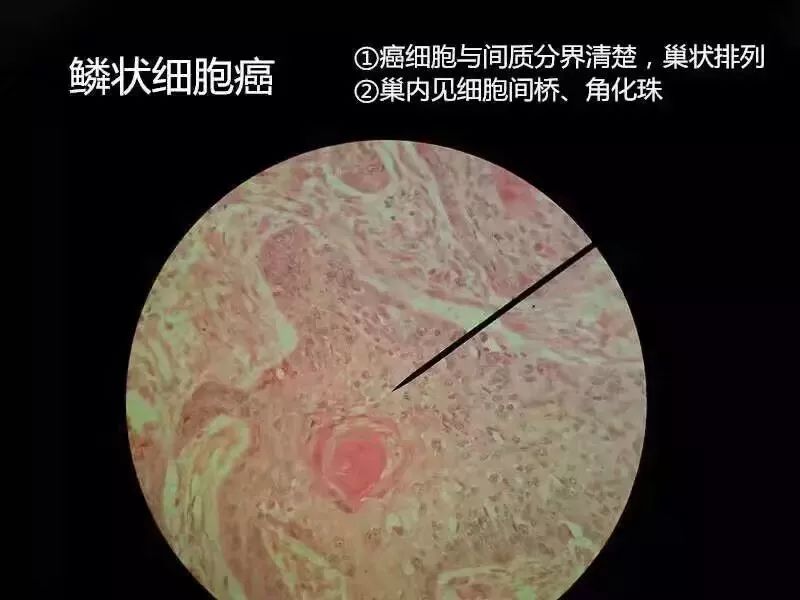 病理学切片库