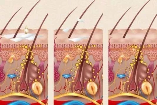 收藏这篇实用防脱发指南,也许你的头发还能抢救一下!