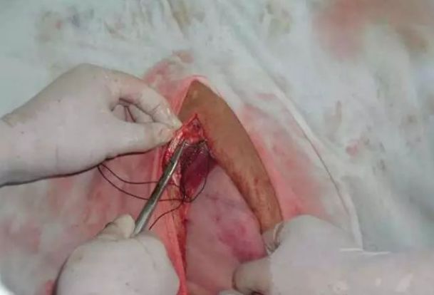 手把手教你瘤胃切开术全图文