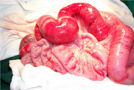 因为便血无外乎消化道出血,但是人体消化道很长,从口咽部位到食道到胃