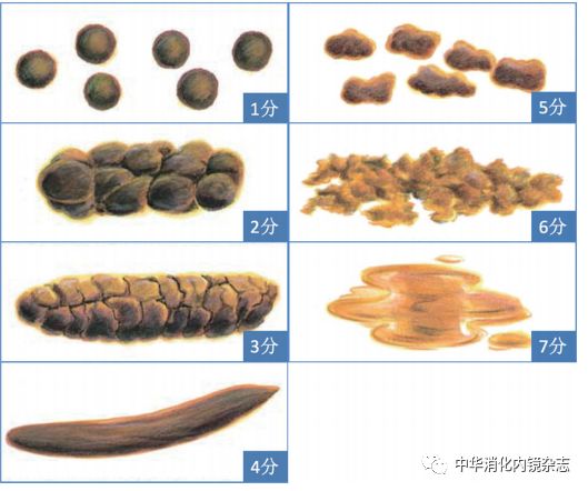 201901論著bristol糞便性狀評估表在兒童結腸鏡檢查前腸道準備中的