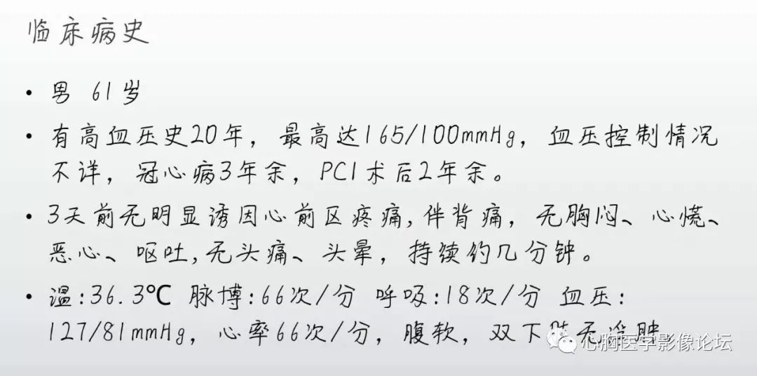 扩张型心肌病该例病例的结果:西安华山中心医院 殷c