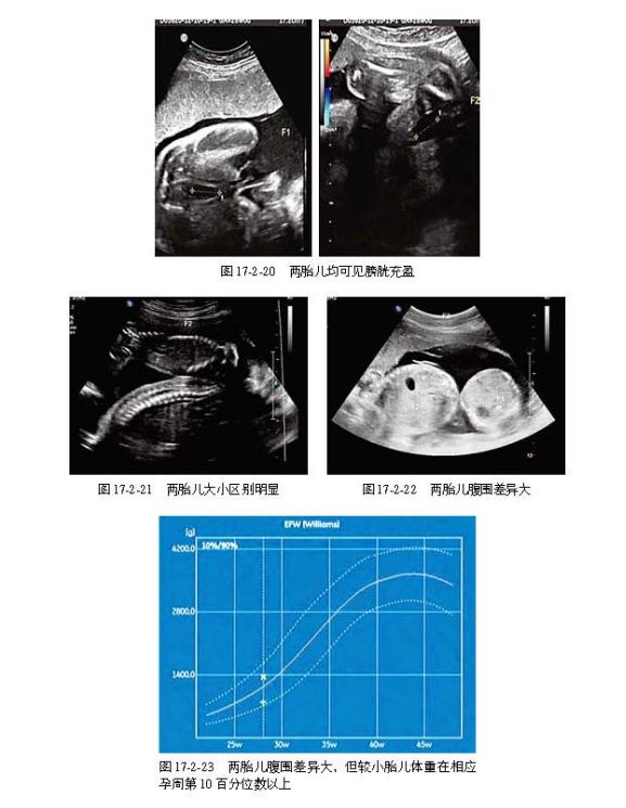 妇产科超声干货175例病例863张高清超声图一次学透