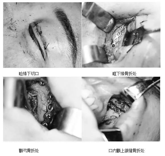 为了更好的服务患者,为了更好的发展我院口腔颌面外科,在今后工作中