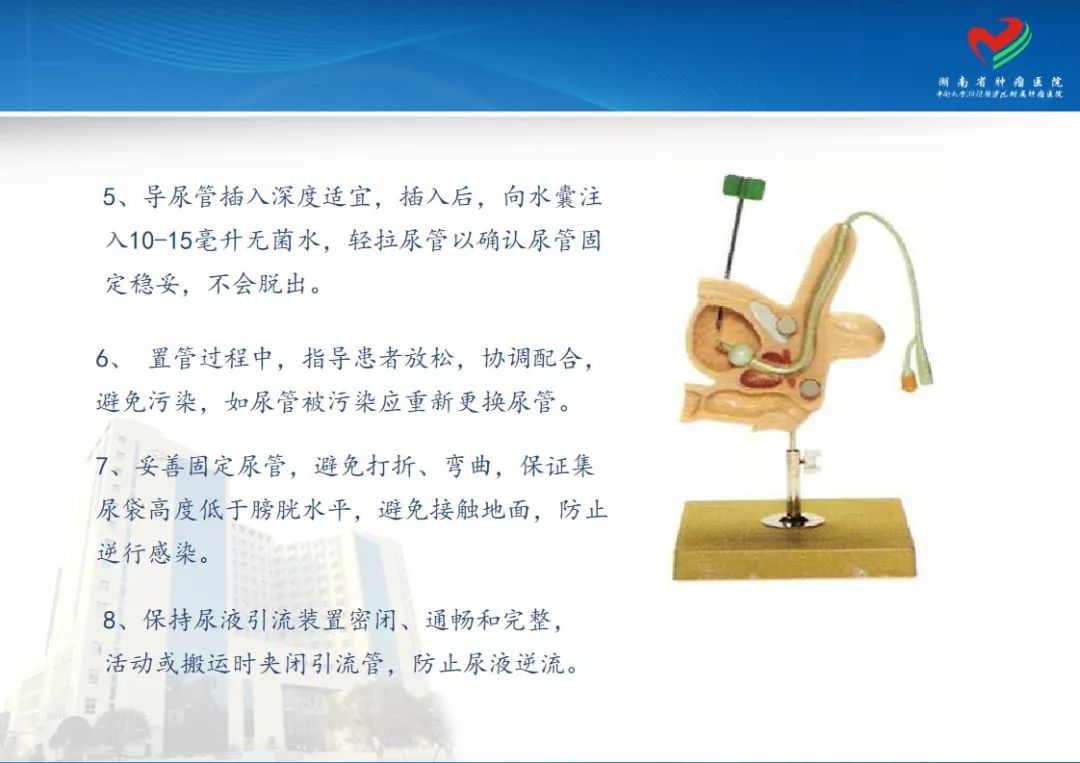 尿管怎么插图示图片