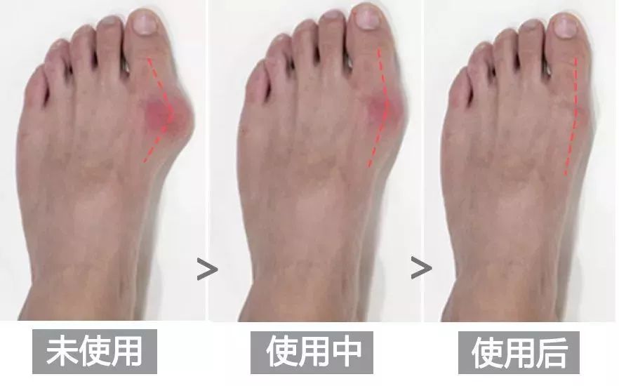 脚趾