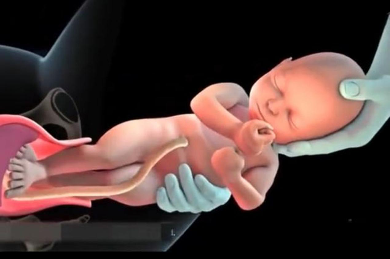 孕妇顺产全过程图片