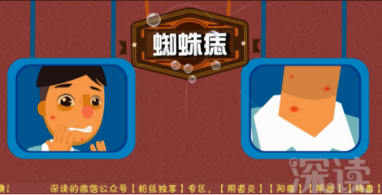 乙肝患者会出现哪些症状?