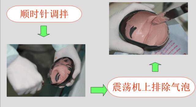 灌注石膏模型的操作步骤—物品准备超硬石膏:20ml:100g~25ml:100g硬质