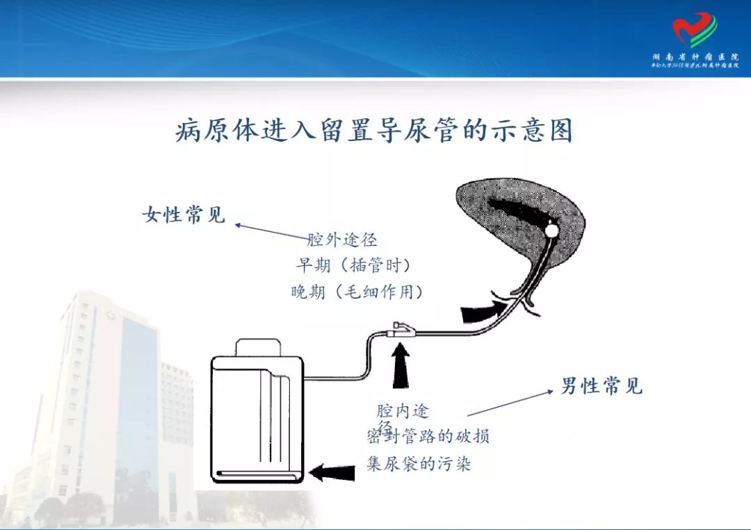 ppt导尿管护理及尿路感染的管理