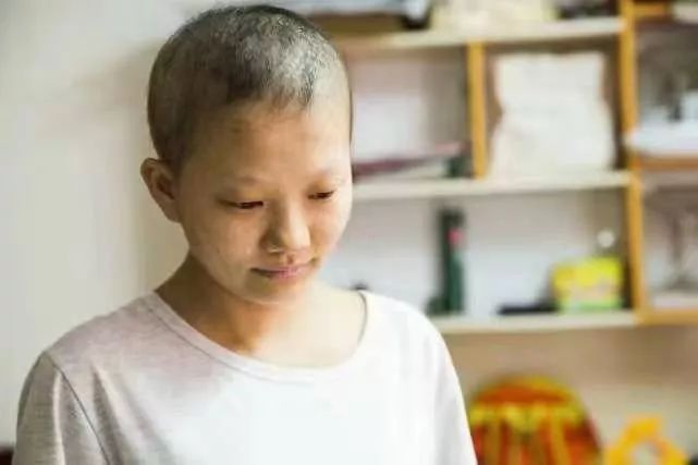 8月21日,记者在长洲区某小区出租屋见到了何林静,她脸色苍白,四肢无力