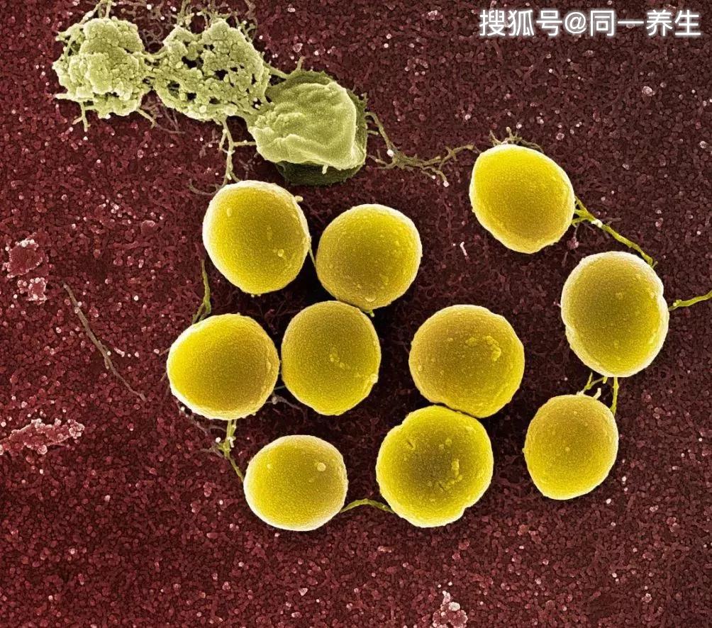 在大多数人的皮肤上都存在着一种叫做金黄色葡萄球菌的细菌,但是它们