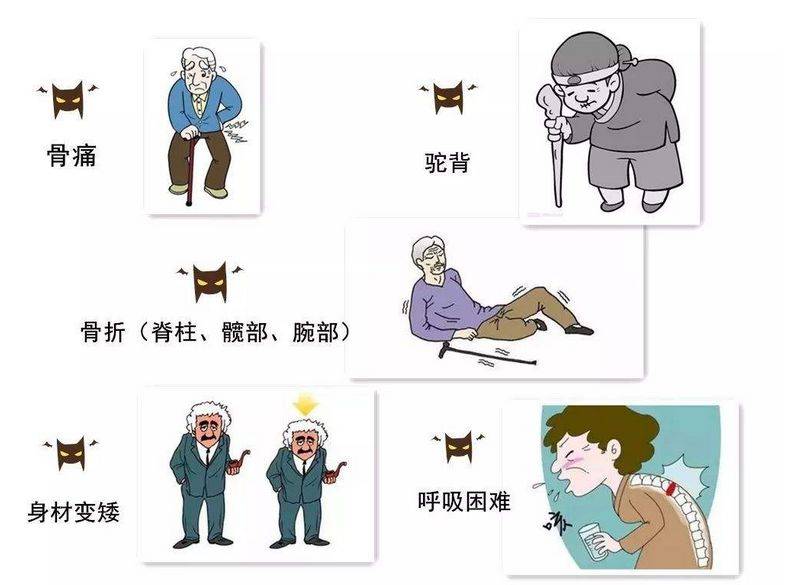 老年人驼背变矮，需警惕骨质疏松，4个方法，帮你强健骨骼-搜狐大视野-搜狐新闻