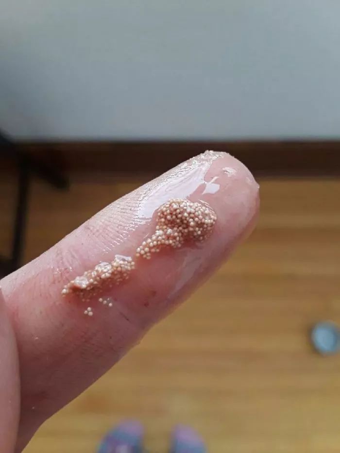 答:这是矿井,颜色来看是锂矿床 鸡蛋的蛋白里面有很多这种东西,是寄生