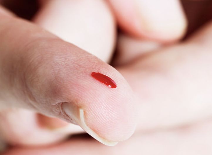 上发现了裂缝,并将骨碎片制成磨片在显微镜下观察,判定死者死于钝器伤