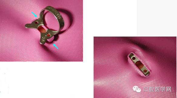 齿科橡皮障的操作