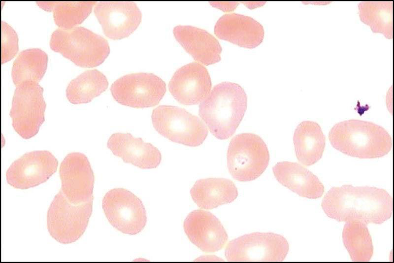 白细胞低会怎么样怎么补白细胞快