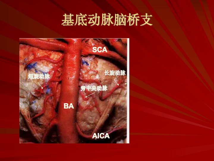 神经解剖脑血管之动脉系和静脉系全227页