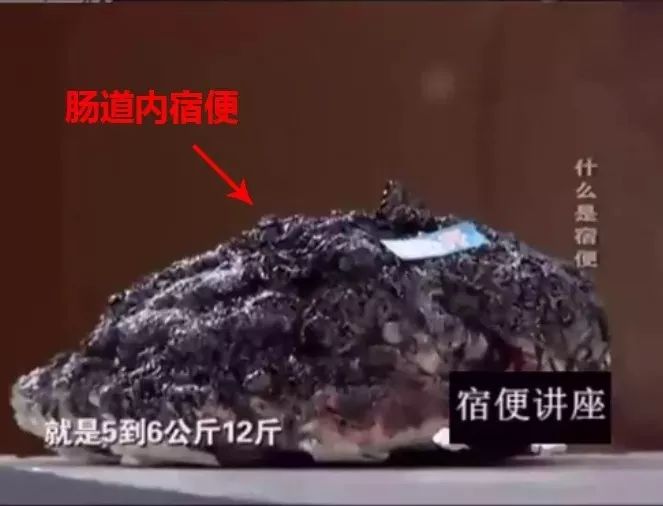 全国女人都在吃它 必买!肠毒排得干干净净,又瘦又美