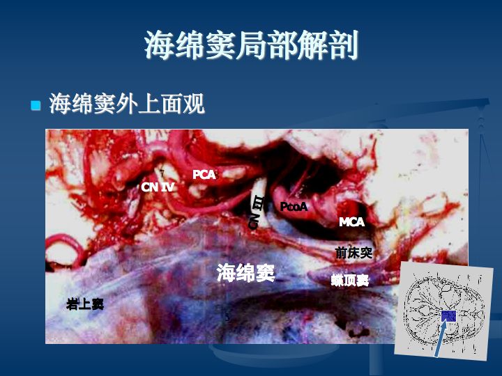 神經解剖腦血管之動脈系和靜脈系全227頁