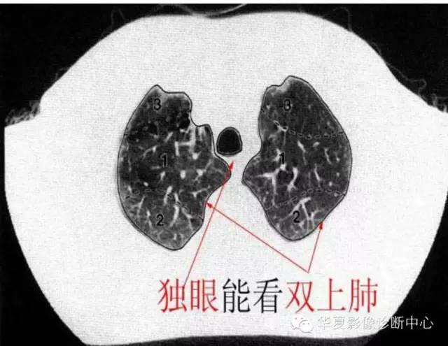 胸部斷層盛宴第二彈胸部ct讀片解剖太實用了上