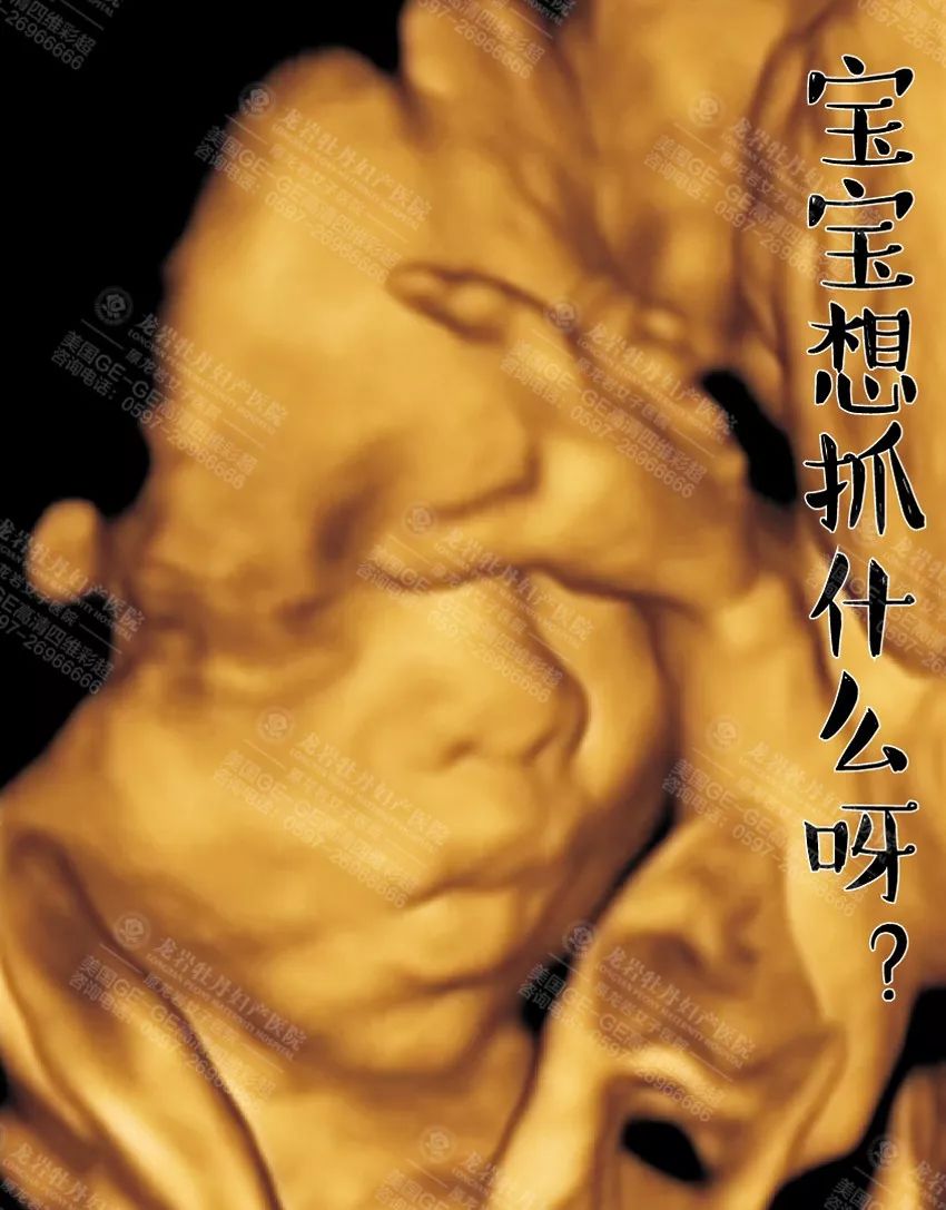 为提高效率,更好的为孕妇服务,牡丹妇产医院引进三台美国ge四维彩超