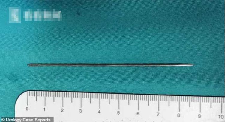 14岁男生把9厘米缝衣针插入尿道强忍痛苦三天才去就医