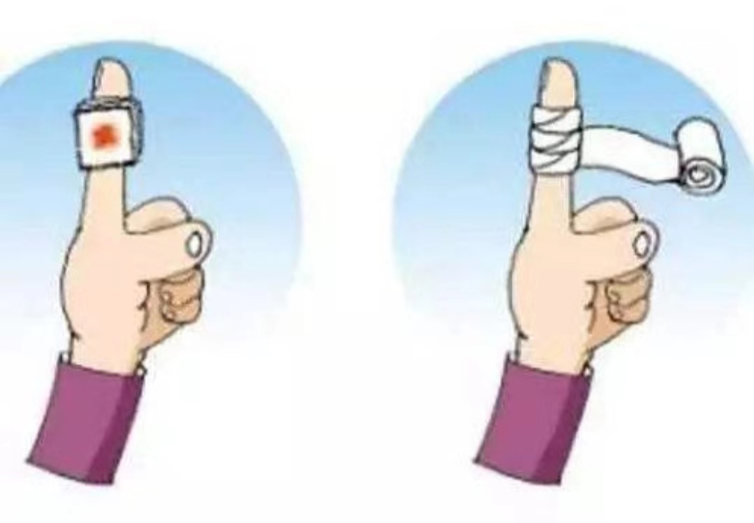 惊了手指割破千万不能用嘴结果很可怕