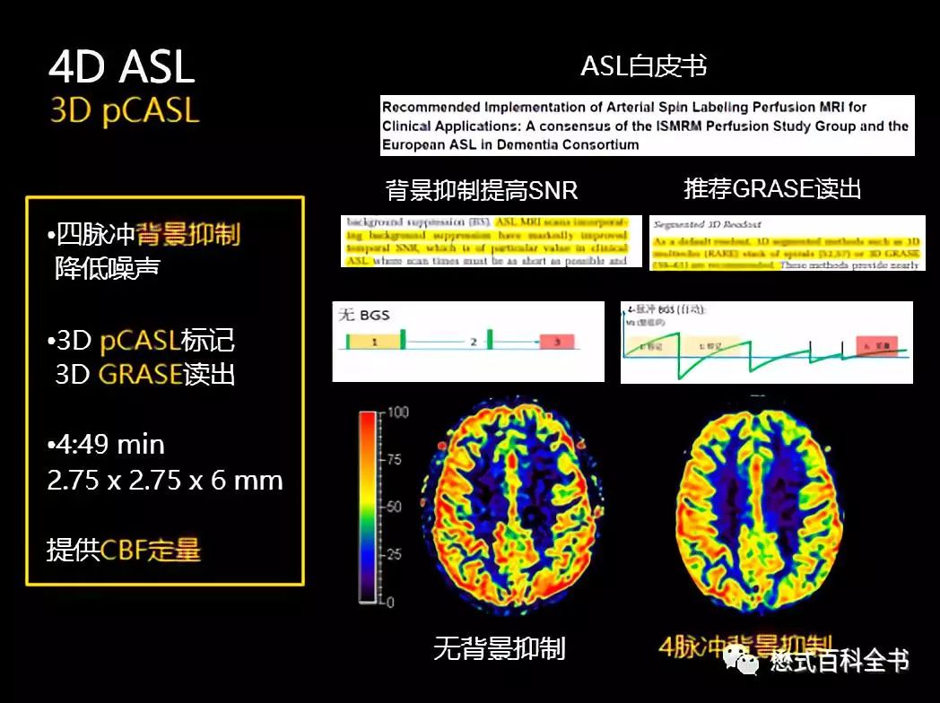 神經影像腦灌注成像磁共振asl技術基本原理及臨床應用一