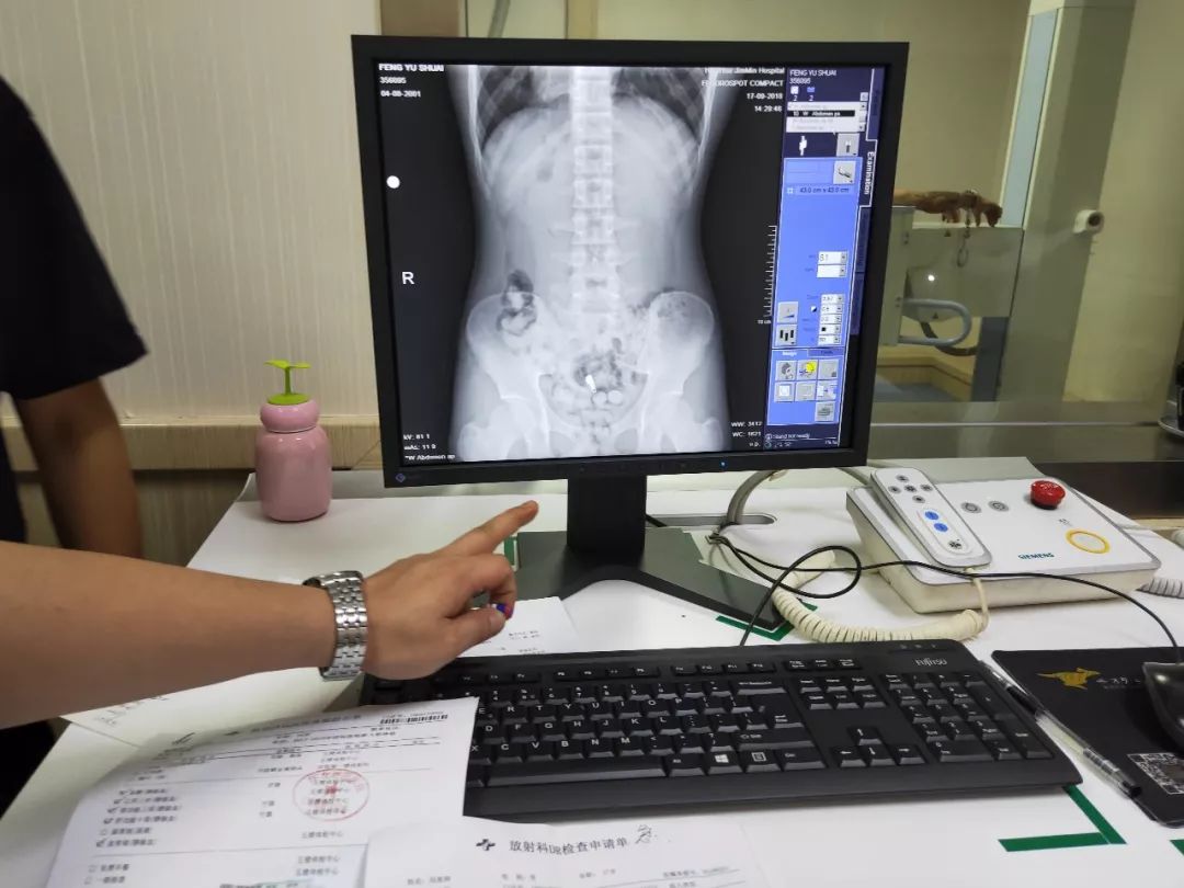 x光机透视下的带毒人腹部.南京铁路公安处供图